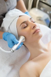 Key Benefits of Microdermabrasion